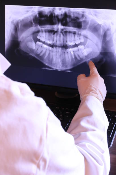 Best Emergency Root Canal Treatment in Liverpool, NY